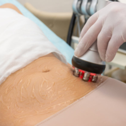 6 Skin Tightening Laser Lifo + RF