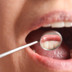 Periodontal 