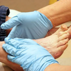 Diabetic Foot Care