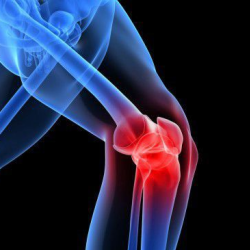 Joint Pain Management