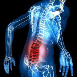 Herniated Disc