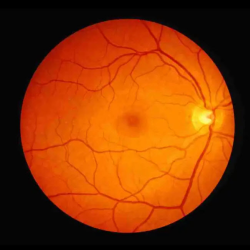  Retinal Imaging