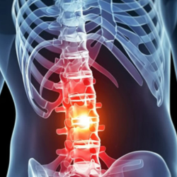 Spinal Cord Injury