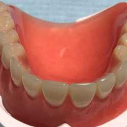 Dentures and Partial Dentures