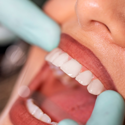 Oral Cancer Exam