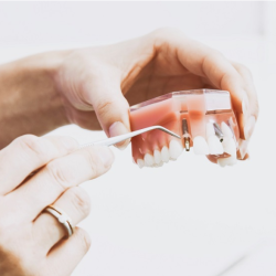 Dental Implants