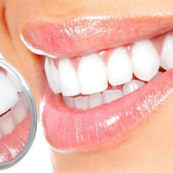 Teeth-Whitening 