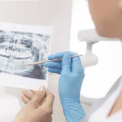  Dental Implants