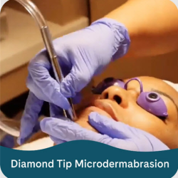 Microdermabrasion