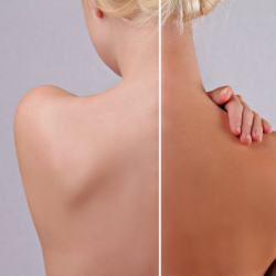 Spray Tan