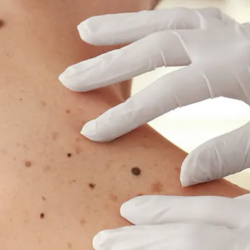 Dermatology