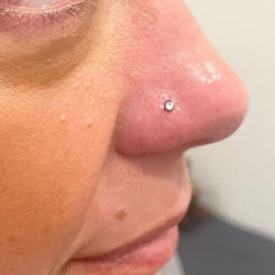 Ear & nose Piercing (Hollow Point Needle)