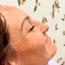 Best Botox in EM, SS, and Lehi Area