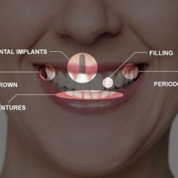 Restorative Dentistry