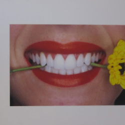 Teeth Whitening