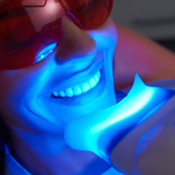 Whitening