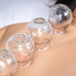 Cupping