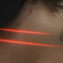 Cold Laser Therapy