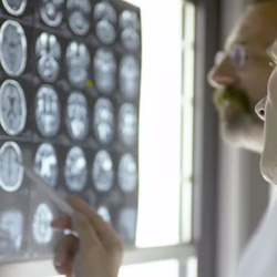 Neurology