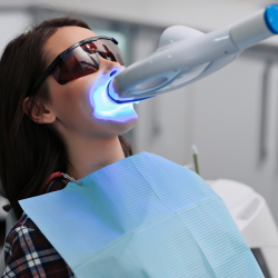 Teeth Whitening