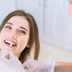 Veneers