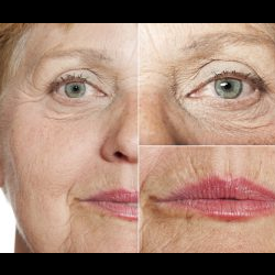 Sun Damaged Skin
