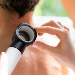 Melanoma Skin Cancer Care 