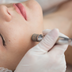 Microdermabrasion