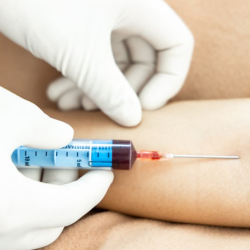 Mobile Blood Draw