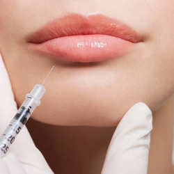 Lip Filler Injections