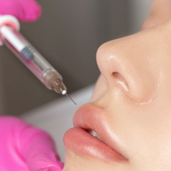 Dermal Filler Treatments