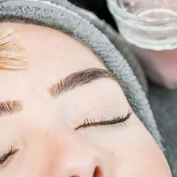 Chemical Peels