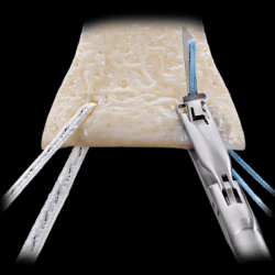Orthobiologics