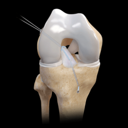 Knee