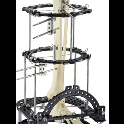 Integra External Fixation System