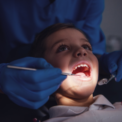 Tooth Extractions