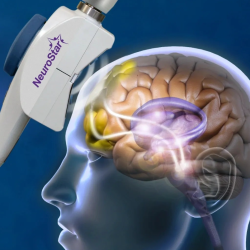 NeuroStar Advanced Therapy (TMS)
