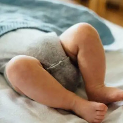 Newborn Circumcision