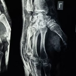 Workers' Compensation Care