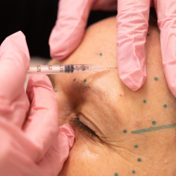 Botox, Xeomin, Dysport, Jeuveau