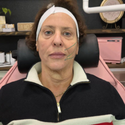 VSoft Smooth PDO threads