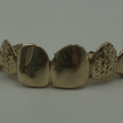 Dental Gold 
