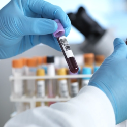 Diagnostic Testing