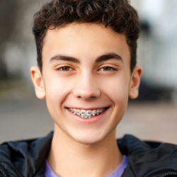 Traditional Braces