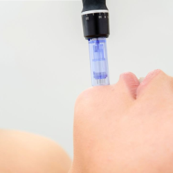 Agnes RF Microneedling	