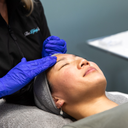 Chemical Peels
