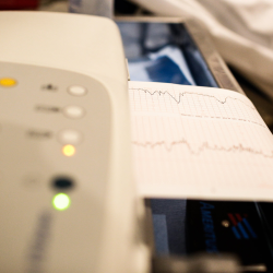 Arrhythmia Evaluation