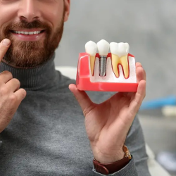 Dental Implants 