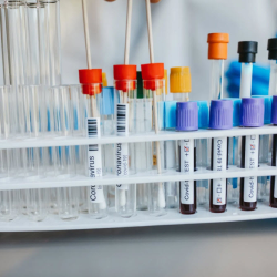 Human Specimen Transportation