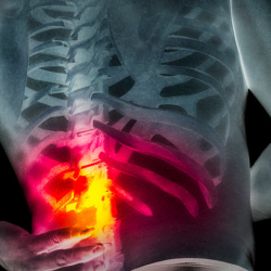 Structural Correction